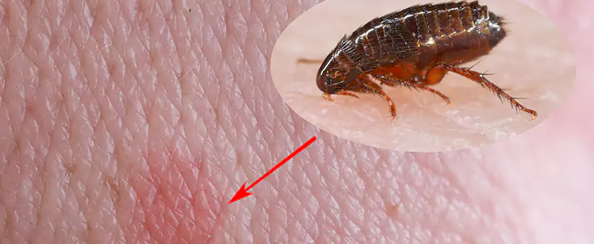 Flea Control for Humans Coppell, TX